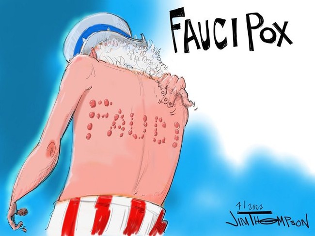 fauci-pox2.jpg